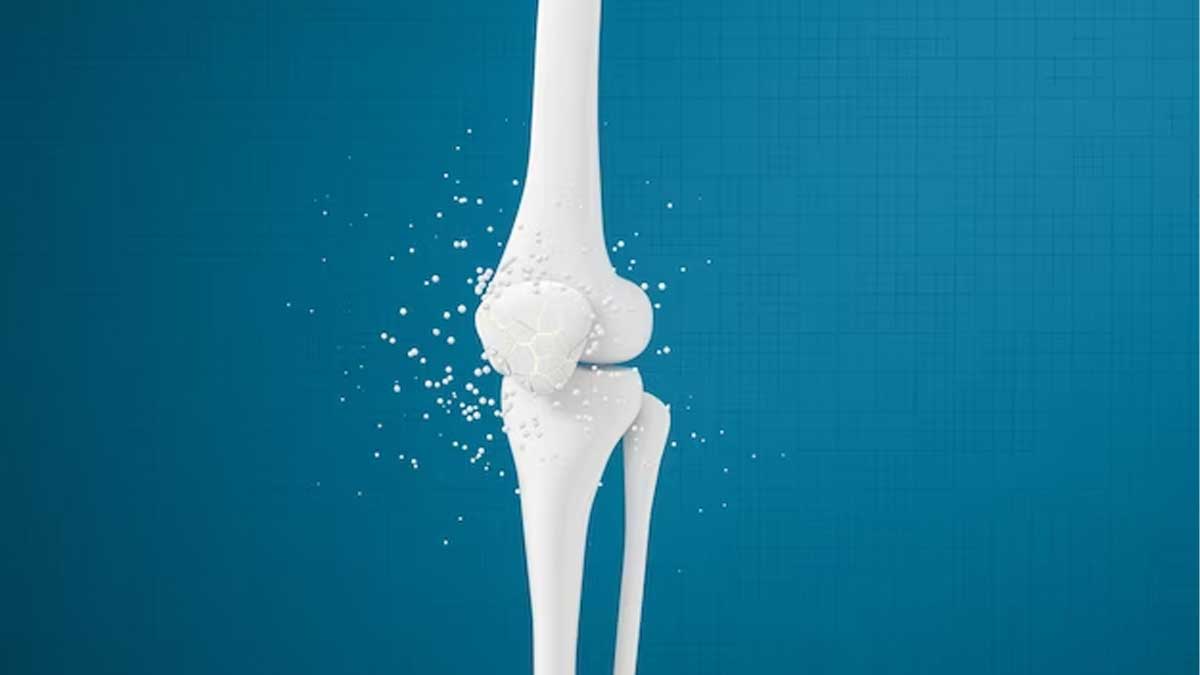 Why Is Osteoporosis More Common In Women
