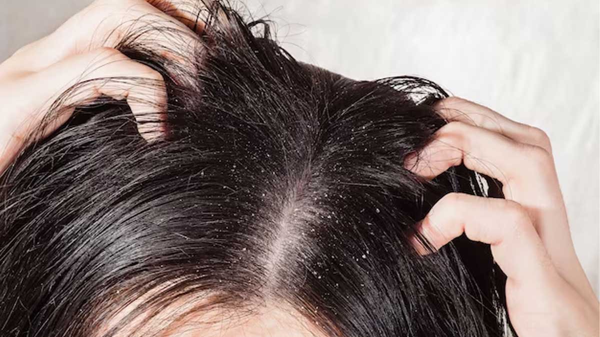 What are some exercises to increase hair growth and stop hair fall? - Quora