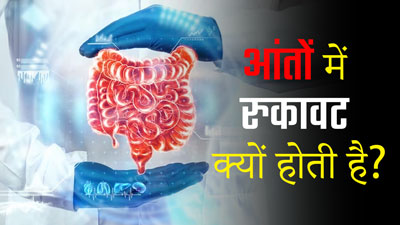 Intestinal Obstruction : आंतों में रुकावट के क्या कारण हो सकते हैं? डॉक्टर से समझें