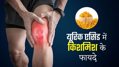 यूरिक एसिड कम करने के लिए करें किशमिश का सेवन, दर्द से मिलेगी राहत