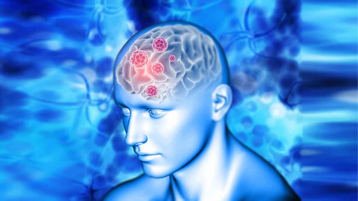 brain-tumour