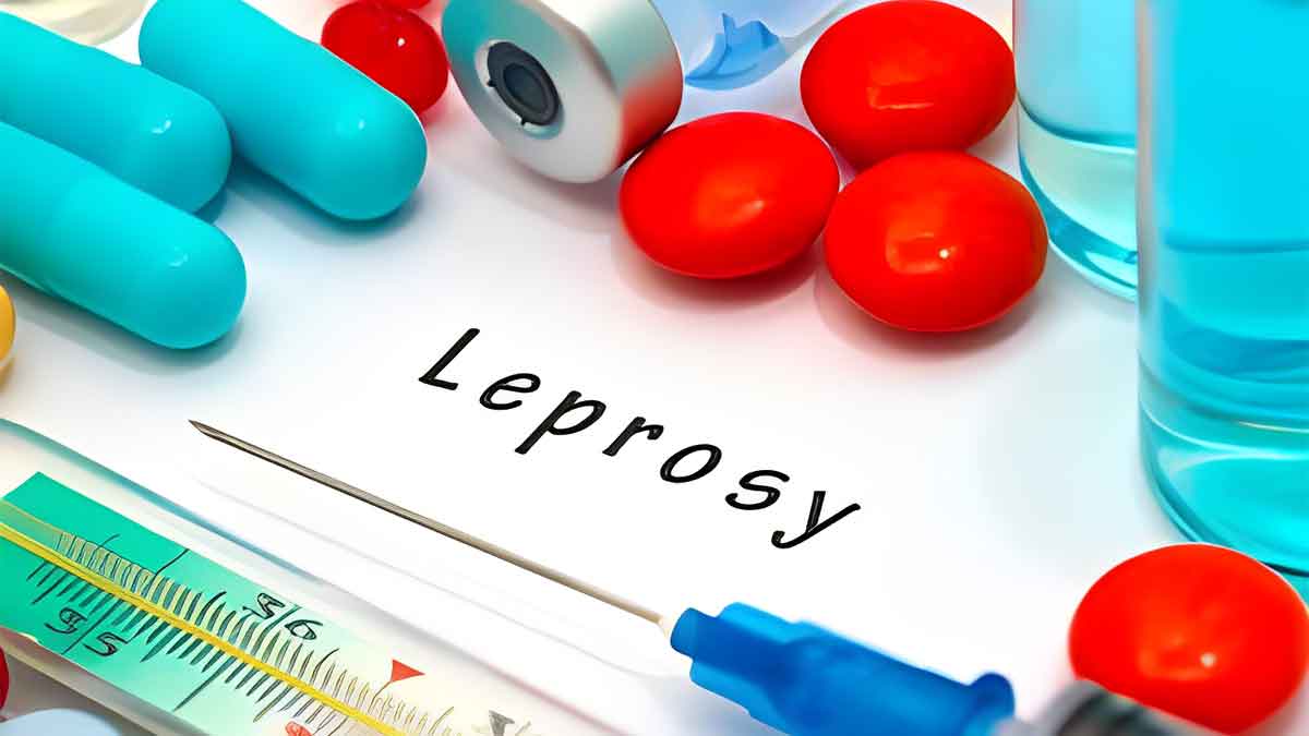 leprosy-treatment