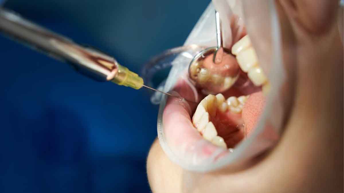 Sharad Pawar's Dental Surgery For Oral Cancer: Here's How Chewing ...