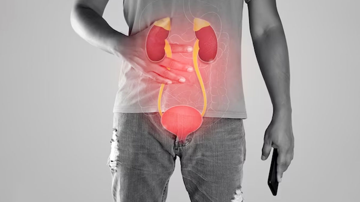 bladder cancer causes 