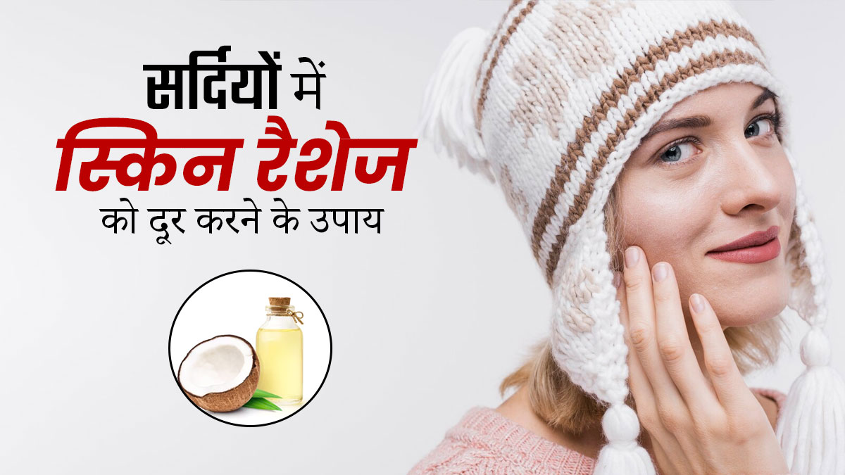 सर्दियों में त्वचा पर हो जाते हैं रैशेज, तो राहत पाने के लिए अपनाएं ये 5 घरेलू उपाय
