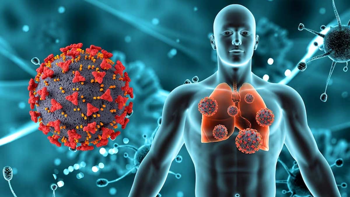 Consistent Decline In Air Quality Can Lead To M. Tuberculosis, Revealed Study