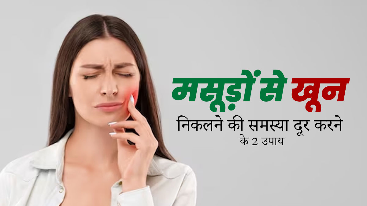 मसूड़ों से खून निकलने पर अपनाएं ये 2 उपाय, मिलेगा आराम और ओरल हेल्थ में होगा सुधार