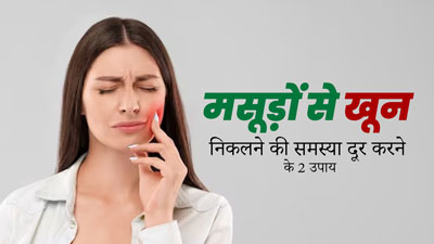 मसूड़ों से खून निकलने पर अपनाएं ये 2 उपाय, मिलेगा आराम और ओरल हेल्थ में होगा सुधार