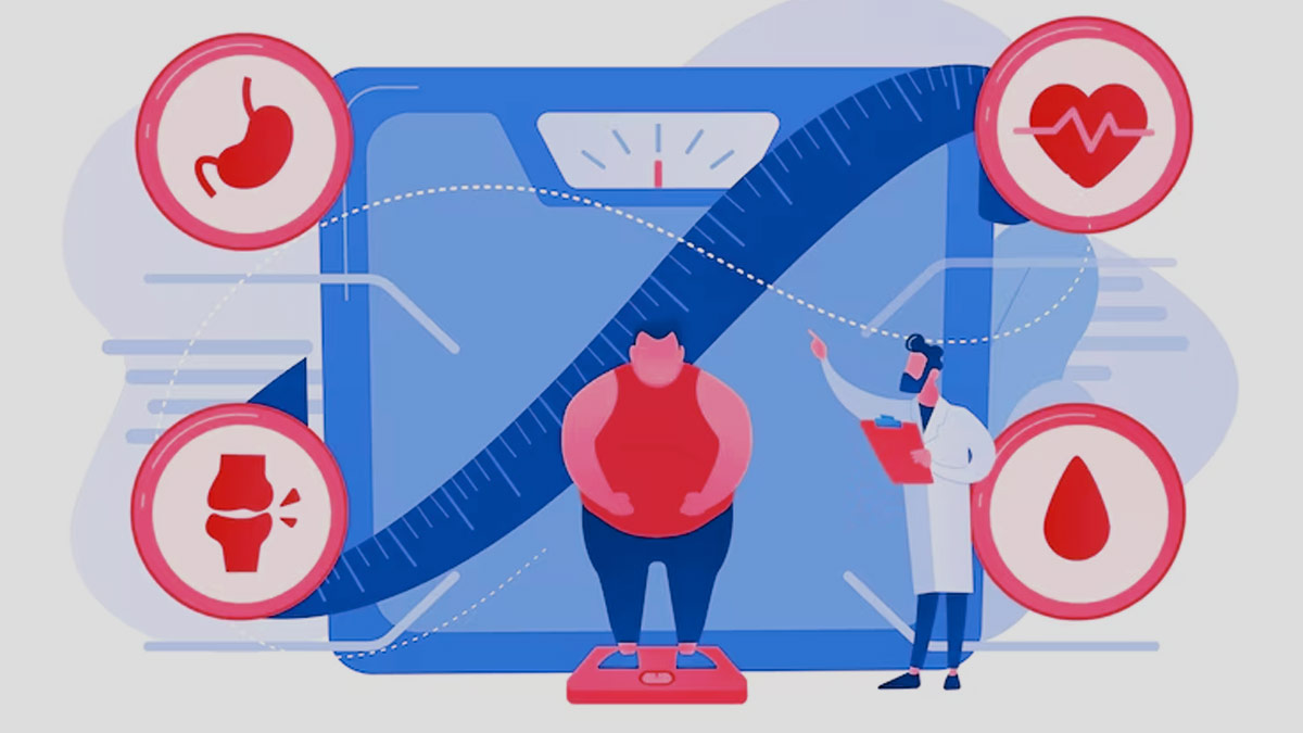 Mumbai Doctors Releases New Obesity Guidelines for Improved Health in India
