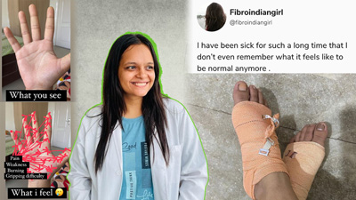 Fighting Fibromyalgia: Navigating Life With Invisible Pain