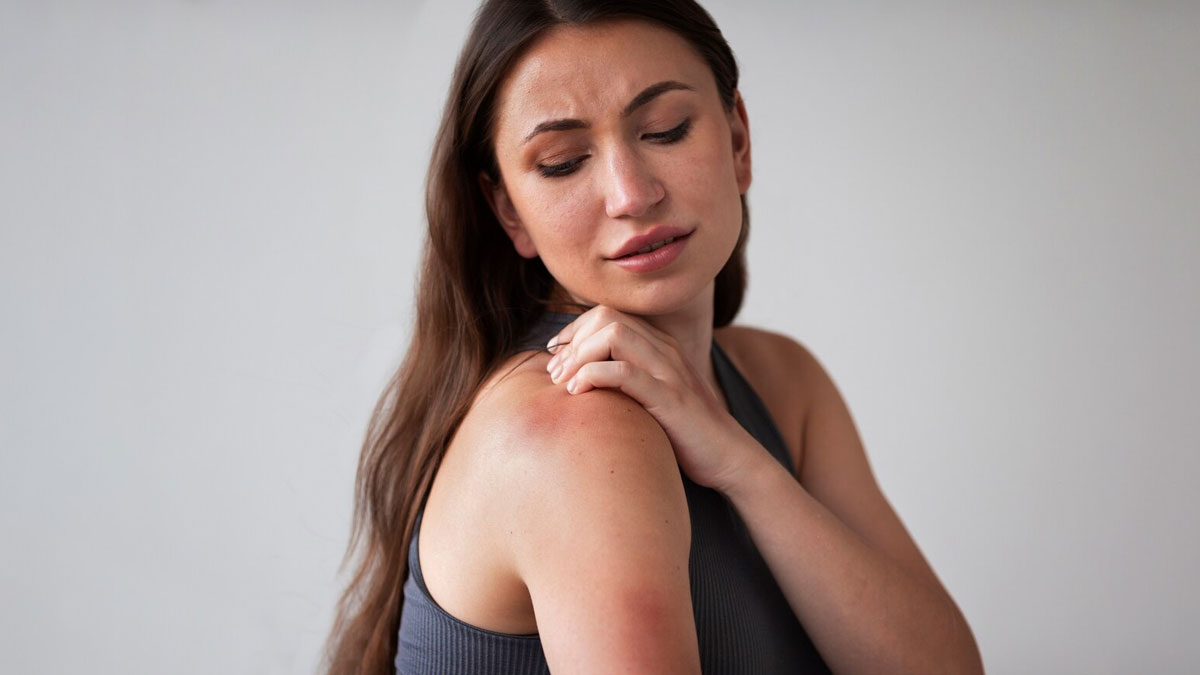 What is Dermatillomania