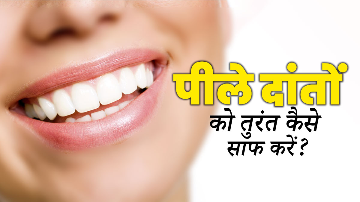Teeth Whitening Tips: पीले दांतों को साफ कैसे करें? जानें 5 घरेलू नुस्खे