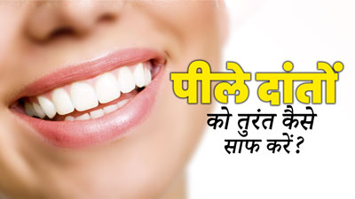 Teeth Whitening Tips: पीले दांतों को साफ कैसे करें? जानें 5 घरेलू नुस्खे