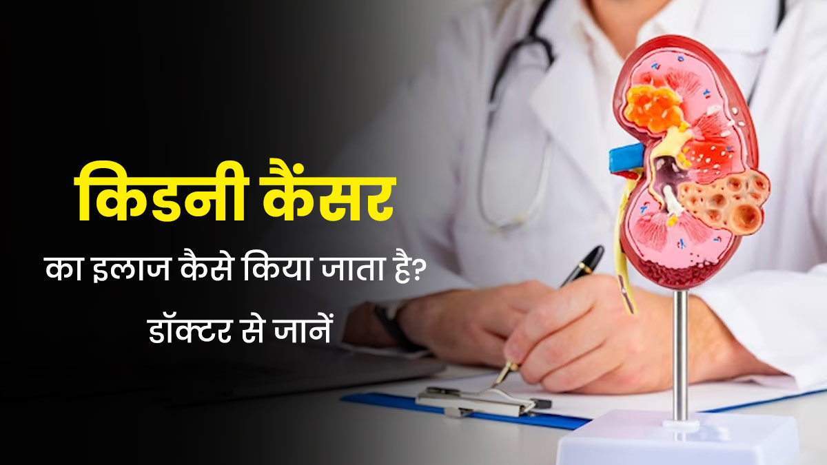 किडनी कैंसर का इलाज कैसे किया जाता है? डॉक्टर से जानें 
