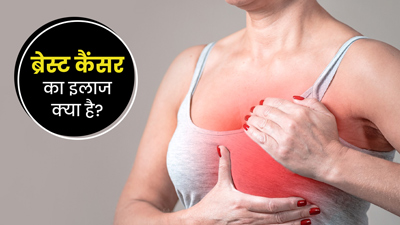ब्रेस्ट कैंसर क्या है? डॉक्टर से जानें इससे जुड़ी सभी जानकारी