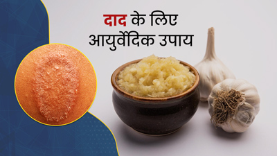 दाद (Ringworm) की समस्या होने पर आजमाएं ये 5 आयुर्वेदिक उपाय, जल्द मिलेगी राहत