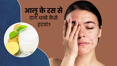 आलू के रस से चेहरे के दाग-धब्बे कैसे हटाएं? जानें 3 तरीके, जिनसे मिलेगा डार्क स्पॉट्स से छुटकारा