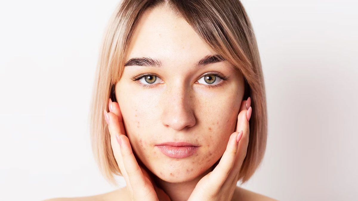 Potato Juice For Dark Spots In Hindi