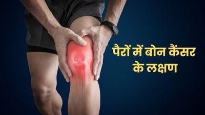 बोन कैंसर की शुरुआत में पैरों में दिखाई देते हैं ये 5 लक्षण, भूलकर भी न करें नजरअंदाज