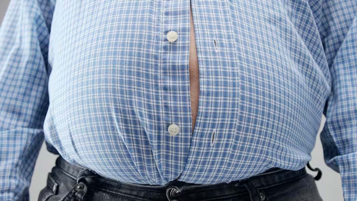 Obesity Is More Than Just An Aesthetic Problem, Here's How It Affects You