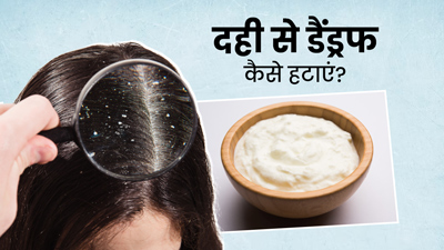 दही से डैंड्रफ कैसे हटाएं? जानें प्रयोग के 4 तरीके