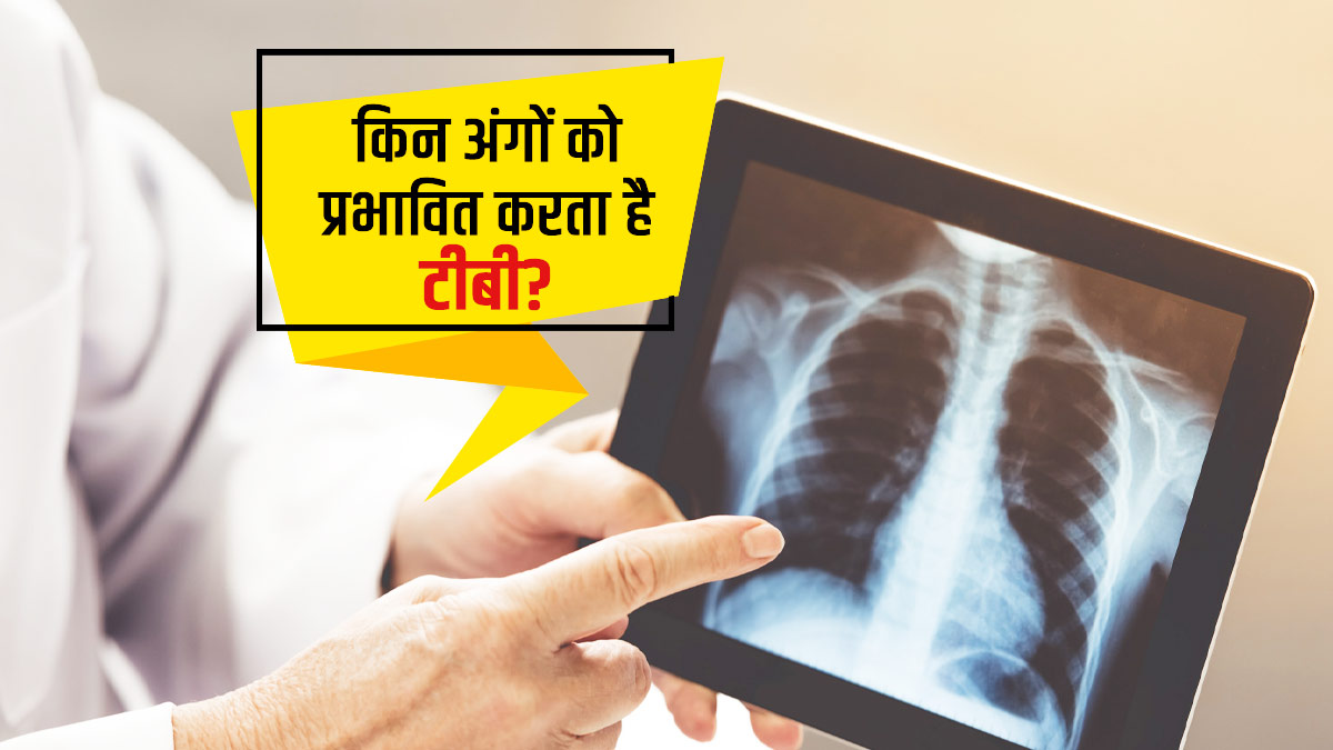 ffects of Tuberculosis On Other Body Parts in Hindi