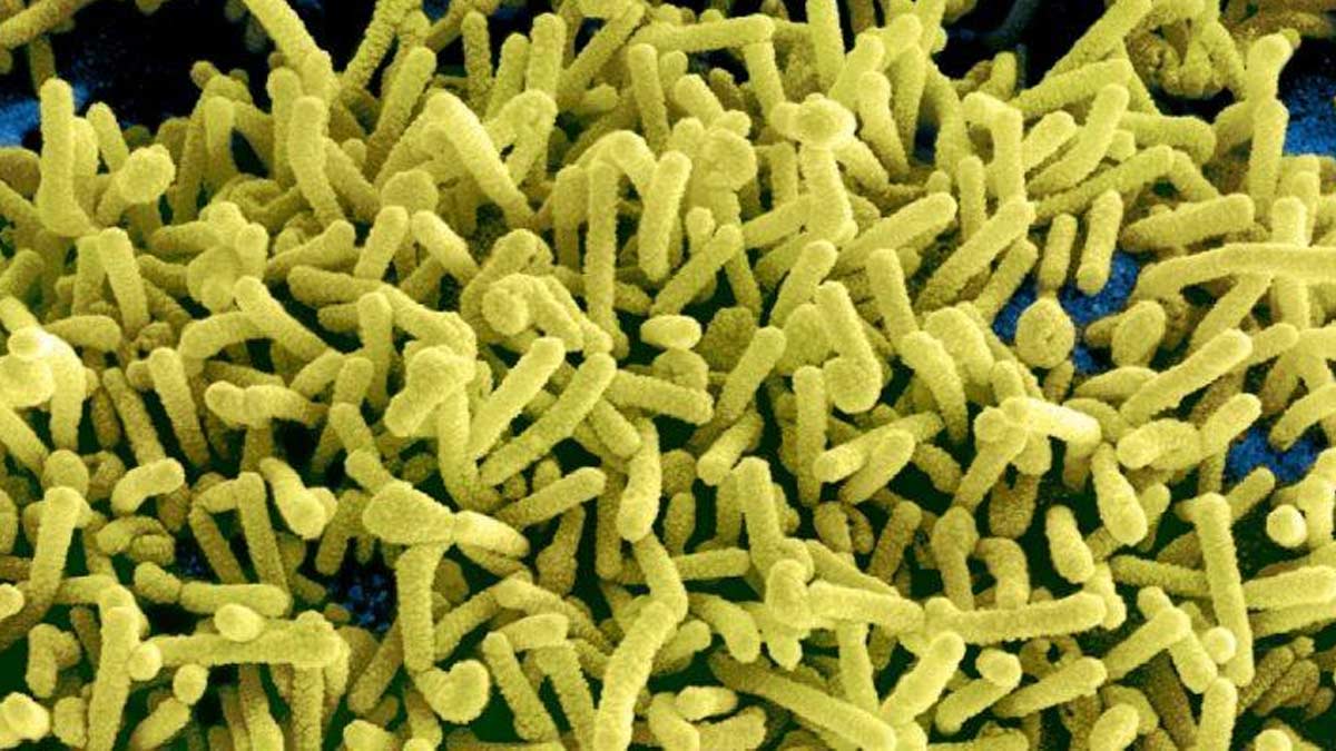 Marburg Virus Outbreak: कोविड के बाद मारबर्ग वायरस को लेकर अलर्ट हुआ WHO, बुखार-सिरदर्द हैं शुरुआती लक्षण