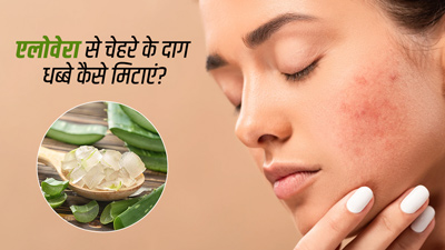 चेहरे पर इन 4 तरीकों से लगाएं एलोवेरा, मिट जाएंगे सारे दाग-धब्बे