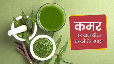 कमर पर हो गए हैं दाने, तो छुटकारा पाने के लिए अपनाएं ये उपाय