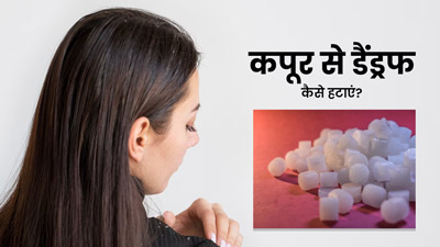 डैंड्रफ से छुटकारा पाने के लिए इन 3 तरीकों से लगाएं कपूर, हेयर फॉल होगा कंट्रोल