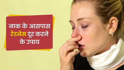नाक के आसपास की त्‍वचा हो गई है लाल, तो लें इन 5 आसान घरेलू उपायों की मदद