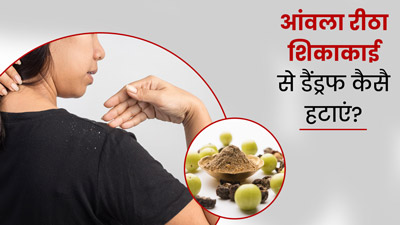 डैंड्रफ हटाने के लिए इस तरह बालों में लगाएं आंवला, रीठा और शिकाकाई, हेयर फॉल होगा कंट्रोल