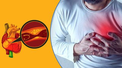 कोरोनरी आर्टरी डिजीज कब और क्यों होती है? जानें इसके लक्षण और कारण