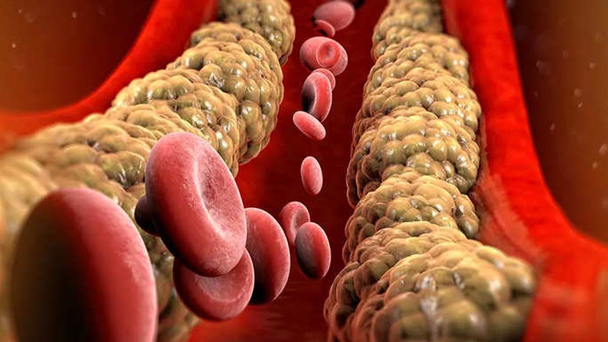 khali pet methi dana for cholesterol