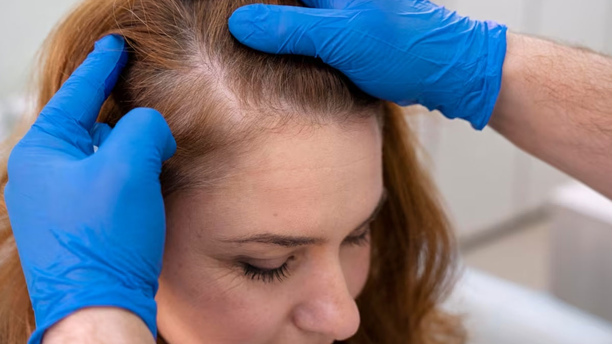 onion juice for hair loss