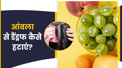 आंवला से डैंड्रफ कैसे हटाएं? जानें प्रयोग के 3 आसान तरीके