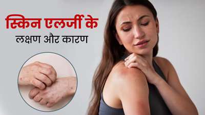 कितने प्रकार की होती है स्किन एलर्जी, जानें इसके लक्षण और कारण