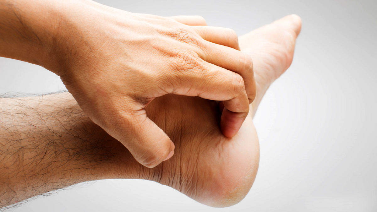 Liver Failure: ​Watch Out! Cracked Heels, Itchy Feet Signal Liver Failure ​