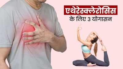 धमनियों में रुकावट (एथेरोस्क्लेरोसिस) की समस्या में करें ये 3 योगासन, ब्लॉकेज खोलने में मिलेगी मदद