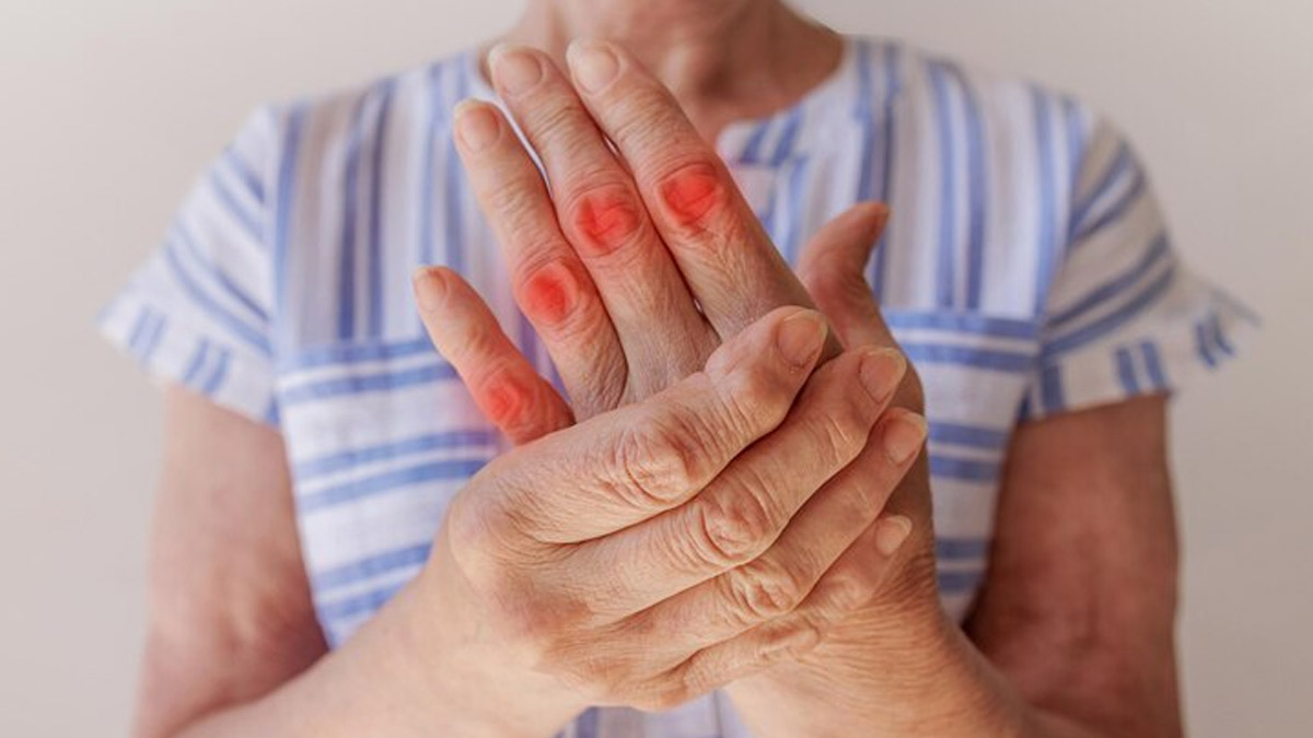 Deciphering The Connection Between Rheumatoid Arthritis And Headache