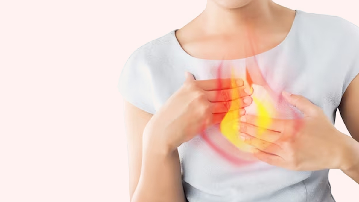acidity heart burn 