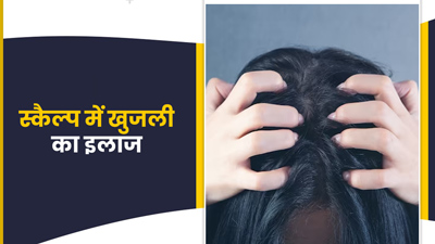 स्‍कैल्‍प में होने वाली खुजली दूर कर सकता है प‍िपरम‍िंट, जानें इस्‍तेमाल के 5 तरीके