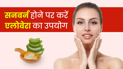 सनबर्न (धूप से त्वचा झुलसने) होने पर इस इन 5 तरीकों से करें एलोवेरा का इस्तेमाल