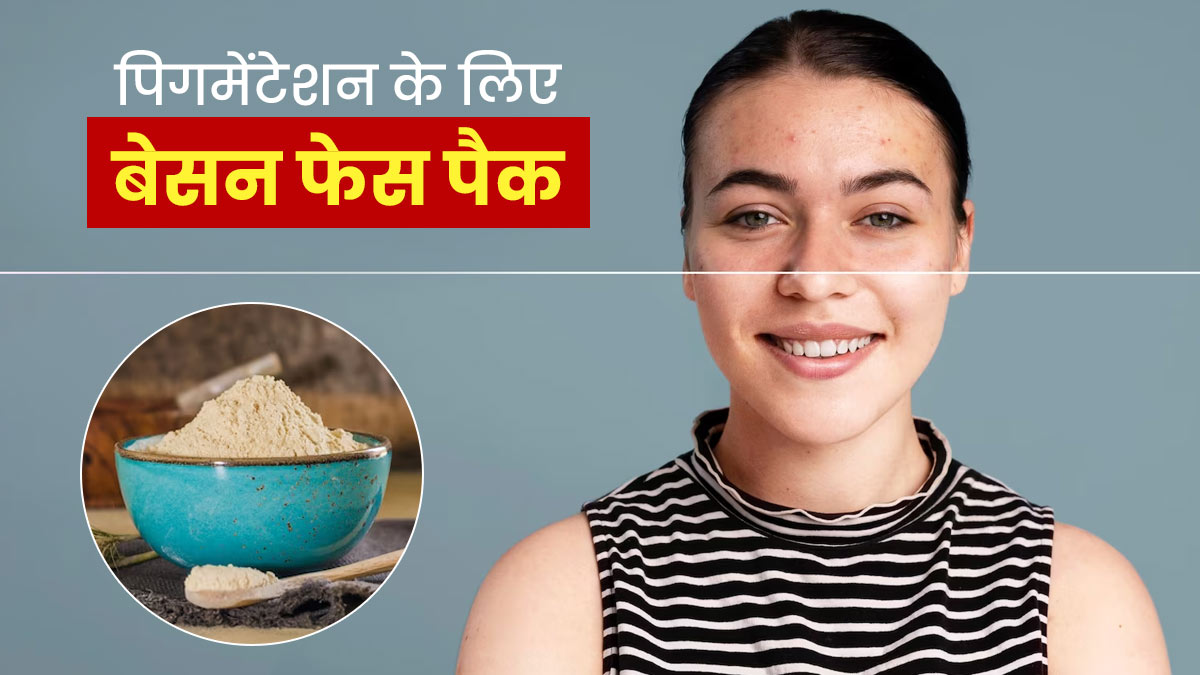 पिगमेंटेशन दूर करने के लिए लगाएं बेसन फेस पैक, त्वचा का कालापन होगा दूर