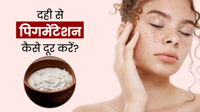 दही से चेहरे की पिगमेंटेशन कैसे दूर करें? जानें प्रयोग के 3 तरीके