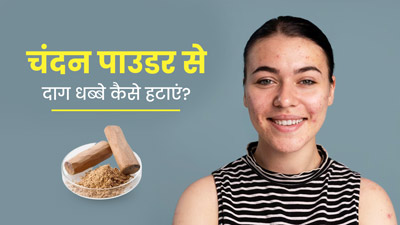 चंदन पाउडर से दाग-धब्बे कैसे हटाएं? जानें 4 तरीके जिनसे चमक उठेगी स्किन