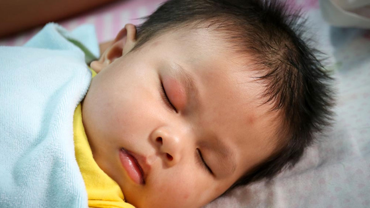 शिशु की आंख में सूजन के साथ नजर आएं ये 5 लक्षण, तो तुरंत लें डॉक्‍टर की मदद 