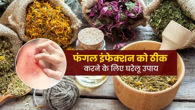 फंगल इंफेक्शन को ठीक करने के लिए अपनाएं ये 7 घरेलू उपाय