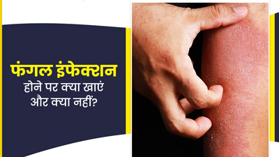फंगल इंफेक्शन होने पर क्या खाना चाहिए और क्या नहीं? जानें एक्सपर्ट से