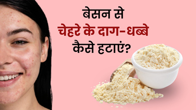 बेसन से चेहरे के काले धब्बे कैसे हटाएं? जानें 3 तरीके और पाएं निखरी त्वचा